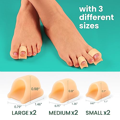 Welnove Hammertoe Corrector - 6 Pack Gel Toe Straighteners