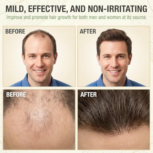 Hair Growth Serum Roll On 20ml | Plant-Based, Fast-Absorbing