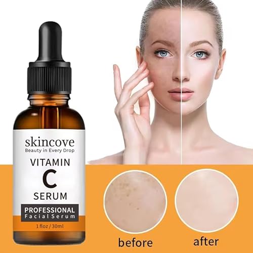 Skincove Vitamin C Serum Anti Aging Facial Serum with Vitamin C, Hyaluronic Acid, Vitamin E Brightening Serum Even Skin Tone, Improve Appearance of Dark Spots, Fine Lines & Wrinkles, 1 Fl Oz