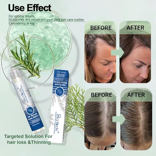 Rosemary Hair Growth Serum Roll-On - 25ml for Thicker Hair