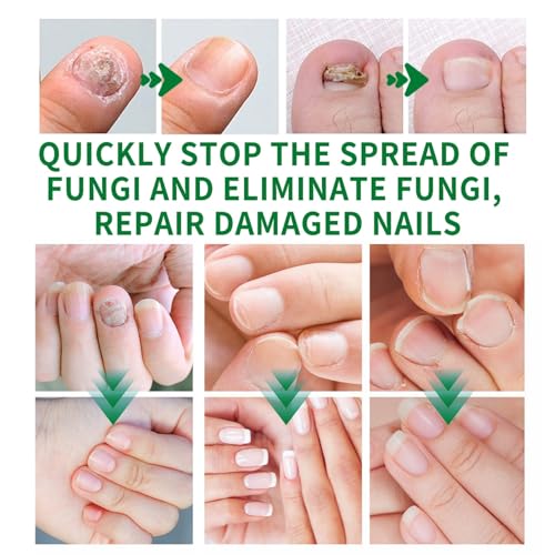 Ginger Nail Growth Serum & Cuticle Care Oil - Nail Strengthener, 3 Pack