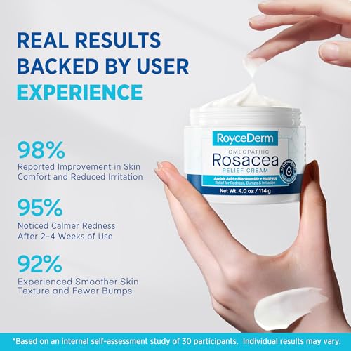 Roycederm Rosacea Treatment Cream with Azelaic Acid & Sulphur