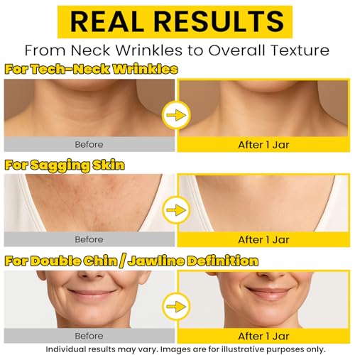 8-in-1 Neck Firming Cream?Retinol & Triple Collagen Moisturizer for Neck,Face,Chest & D?collet??Tighten, Lift&Smooth the Look of Sagging Crepey Skin, Fine Lines&Wrinkles?Women&Men,1.7 Fl Oz