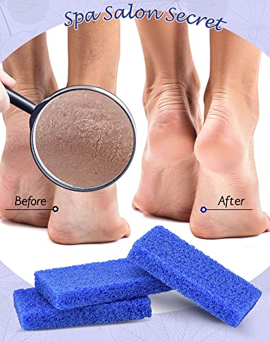 Maryton Disposable Pedicure Pumice Stones - Coarse Grit Callus Remover (40 Pack)