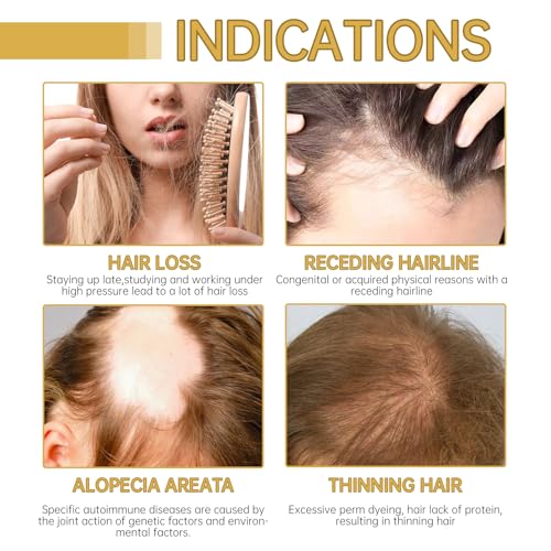 Natural Hair Growth Oil, Rosemary Oil Organic, For Dry, Damaged Hair,