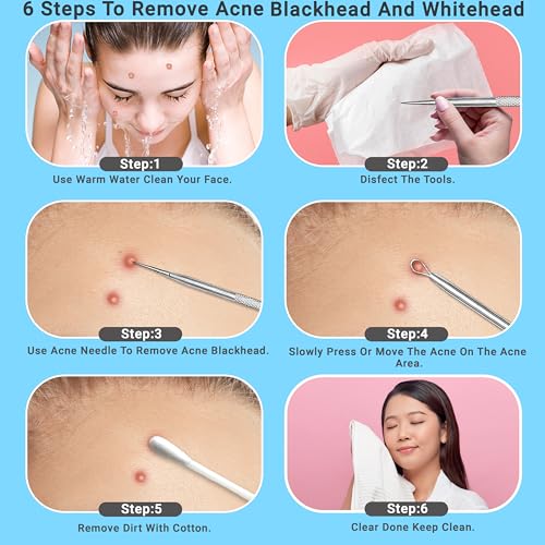 Stainless Steel Pimple Extractor Tool 2-Pc Set Blackhead Remover
