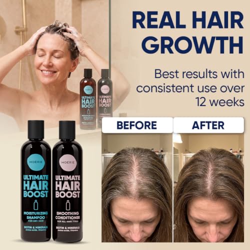 Moerie Hair Growth Shampoo & Conditioner Set 16.9oz