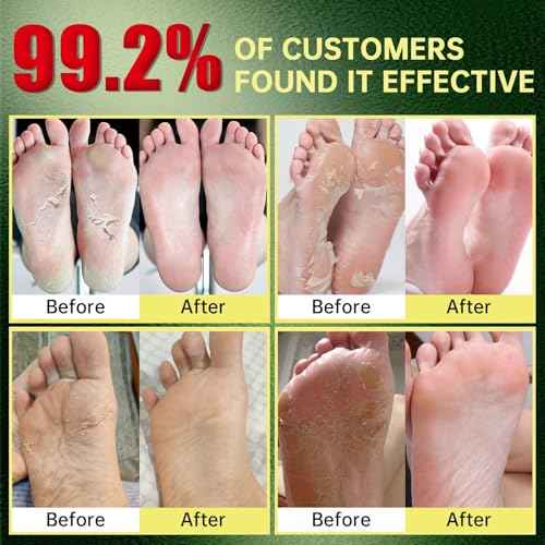 Foot Peeling Mask, Natural Exfoliating Foot Mask, Dead Skin Callus Remover Repair Heels, Hydrating Foot Care for Dry Cracked Feet£¨3 PacK£©
