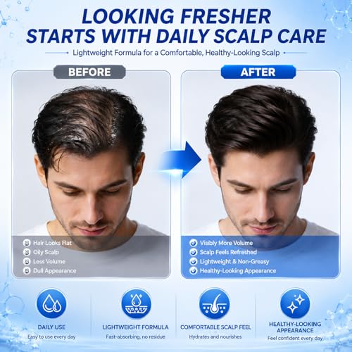 Hair Growth Serum with Caffeine & Niacinamide | Lightweight Scalp Care 30ml