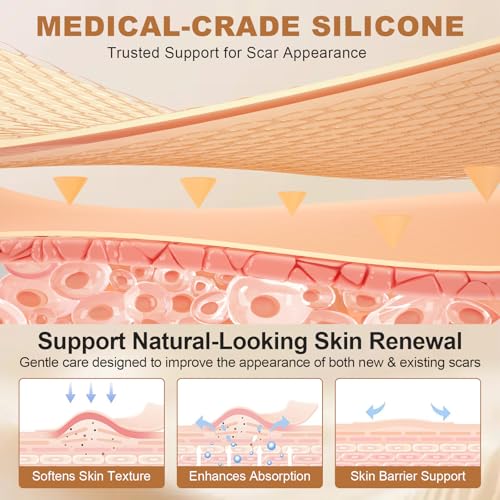 Silicone Scar Sheets for C-Section & Surgery - 3M Roll (1.6"x118") - Reusable & Hypoallergenic Scar Tape to Fade Scars from Acne, Burns, Keloid | Doctor Recommended