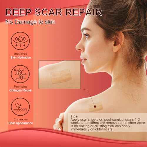 Silicone Scar Sheets (1.6¡±x 60¡± Roll-1.5M), Medical Grade Silicone Scar Tape Roll, Reusable Silicone Scar Strip, Professional Scar Removal Sheets for Surgery, C-Section, Burn, Keloid, Acne Etc