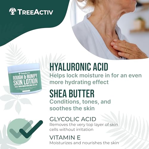 TreeActiv Rough and Bumpy Skin Lotion, 8 fl oz, With Hyaluronic Acid, Shea Butter and Vitamin E, Nourishing Lotion for Rough and Bumpy Skin, Moisturizing Strawberry Legs, For All Skin Types