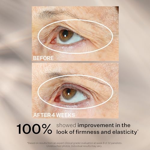 StriVectin Peptight Face Lift Serum | Tighten & Brighten