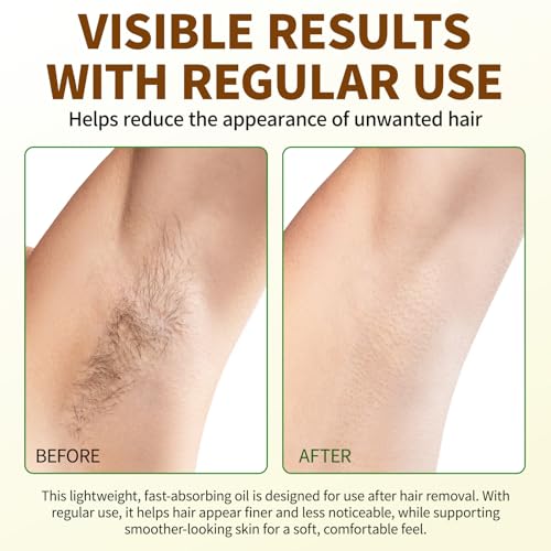 Cyperus Rotundus Oil for Hair Reduction & Skin Care