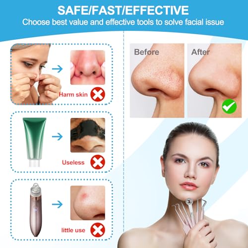 Pimple Popper Tool Kit - 9-Function Blackhead Remover (5 Piece)
