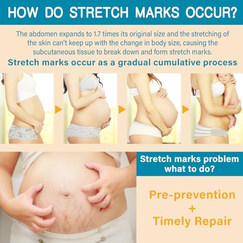 Pregnancy Stretch Mark Oil - Cocoa Butter & Vitamin E, 4.06oz