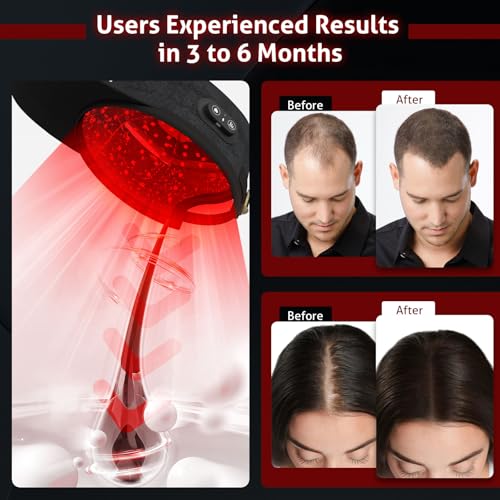 Laser Hair Growth Cap - 108 Red Light LEDs, Wireless