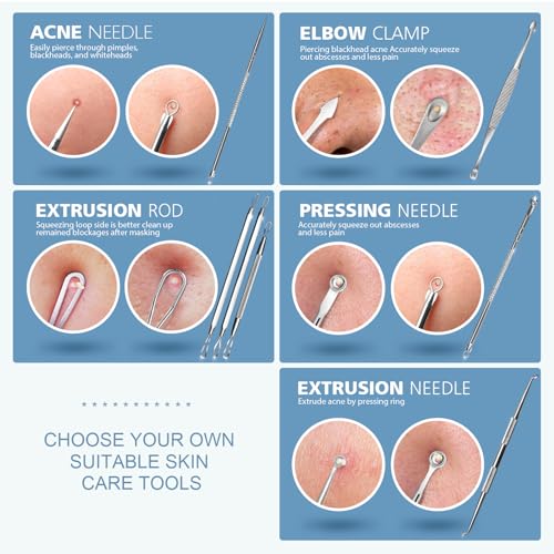 Teenitor 7-in-1 Pimple Popper Tool Kit Stainless Steel Blackhead Remover