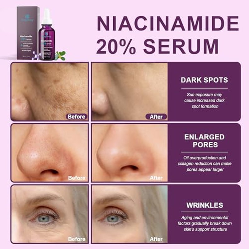 20% Niacinamide Serum for Face,Niacinamide Vitamin B3 B5 Concentrated Serum,Moisturizer,Pore Minimizer,Anti-aging Discoloration Correcting Treatment