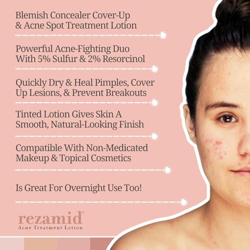 Acne Spot Treatment Lotion For Pimples - Skin Clearing Blemish Concealer For Oily Skin With 5% Sulfur & 2% Resorcinol - Sensitive Skin Makeup - Skin Tone Matching Foundation - 2oz