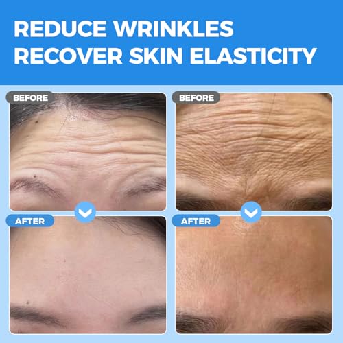 Okela Forehead Wrinkle Patches Overnight 20pcs Collagen