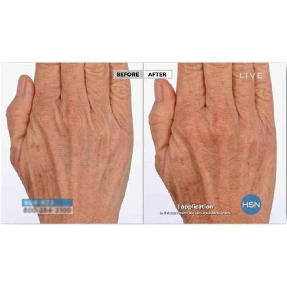 NASSIF MD Hydro-Screen Face And Body Souffle, Hydrating Skin Moisturizer, Hyaluronic Acid, Omega 3, Anti Aging, Even Skin Tone, 4 Fl Oz