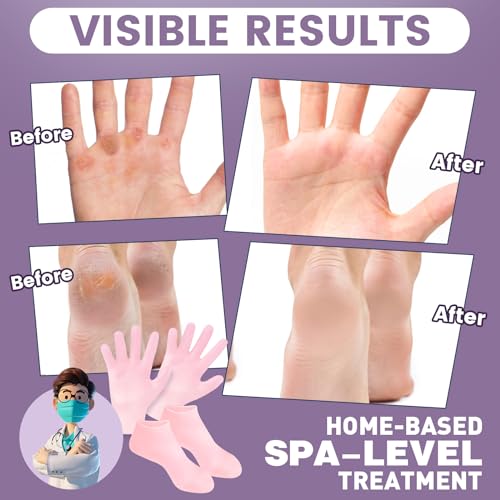 Silicone Moisturizing Socks & Gloves Set for Dry Cracked Feet & Hands, 4 Pairs