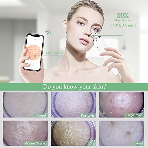 Blackhead Remover Pore Vacuum with 5MP Camera & 20X Magnification