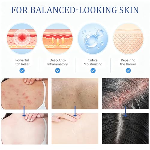 Folliculitis Care Cream for Body & Scalp - 120g