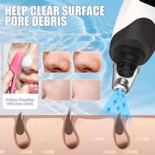 Gackoko Blackhead Remover Vacuum with Adjustable Suction & Tools