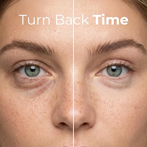 Retinol Eye Gel for Dark Circles & Bags