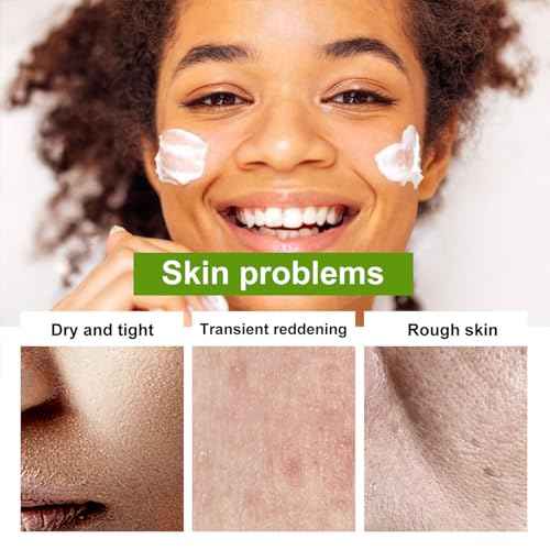 Aloe Vera Moisturizer Facial Cream,Facial Cream With 98% Organic Aloe Vera,Anti Wrinkle Face Moisturize Cream,For Dry Skin,Acne Scars,Soft,Moisturizing,And Delicate Skin