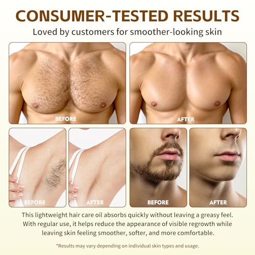 Cyperus Rotundus Oil for Hair Removal & Skin Care