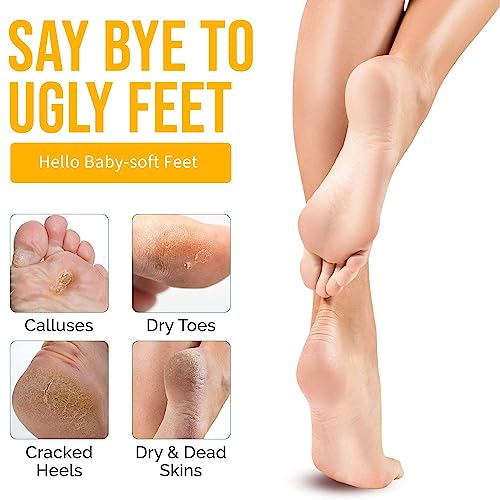 Extra Strong Peeling Oil, Yellow Peeling Oil for Dark Skin, Exfoliating Peeling Solution for Body, Hand, Feet and Face All Skin Type