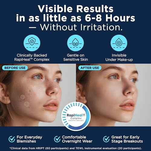 Pimple Patches for Face - 134 Count Hydrocolloid Acne Patches - Zit, Blemish, Cystic Acne Dots & Dark Spot Treatment - Invisible Clear Pimple Patch Stickers for Forehead, Chin, Nose, 3 Sizes (S, M, L)