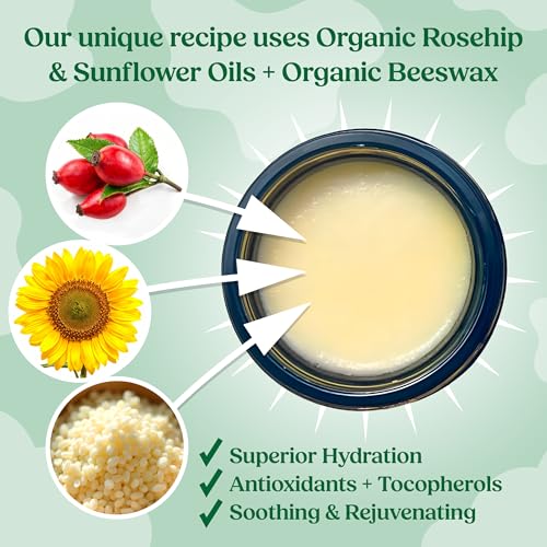 Organic Beef Tallow Balm with Frankincense, Lavender, & Rosehip Oil, 1 oz ? Hand Made in USA Tallow Moisturizer for Dry, Sensitive Skin, Rosacea, Eczema | Natural Hydration for Face & Body