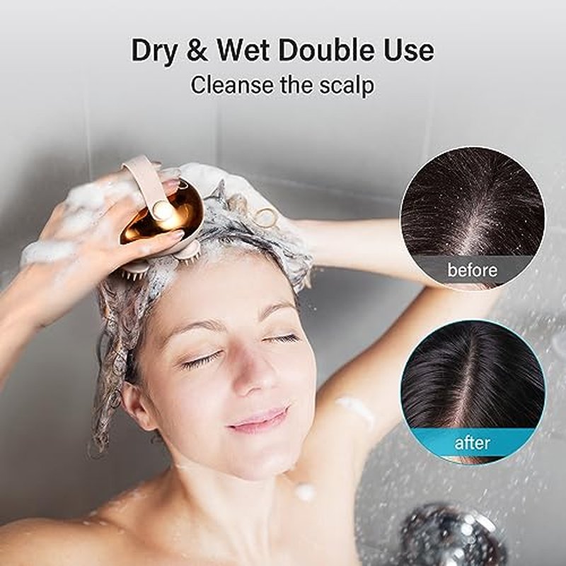 Arboleaf Electric Scalp Massager with 128 Massage Nodes