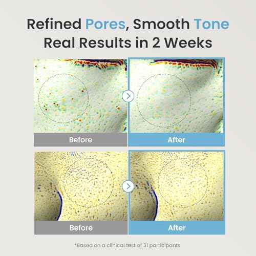 The Face Shop Alltimate Niacinamide 10% Serum for Face with Caffeine & Peptide, Korean Skin Care, Oil Control & Pores Reducer, Improve Skin Elasticity, Face Serum for Sensitive Skin, Non-comedogenic