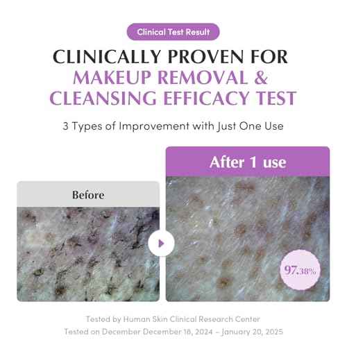 EQQUALBERRY Purple Rice Pore Smoothing Cleansing Oil ? Deep Cleansing for Pores & Blackheads | Korean Oil Cleanser for Face & Makeup Remover | Hydrating & Soothing Formula, 6.76 fl.oz