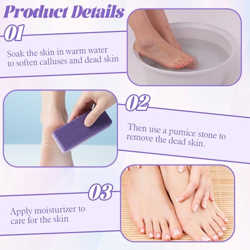 Grevosea Double-Sided Foot Pumice Stones 5-Pack for Callus & Dead Skin Removal