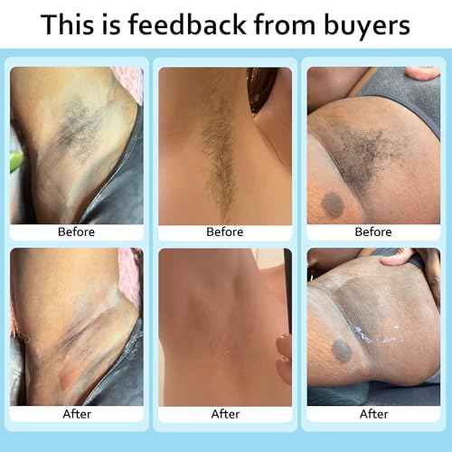 Waxing Kit for Women Men, Wax Warmer Hair Removal at Home with Hard Wax Beads & Silicone Pot, Suitable for Sensitive Skin Brazilian Bikini, Facial, Underarms, Legs, Full body