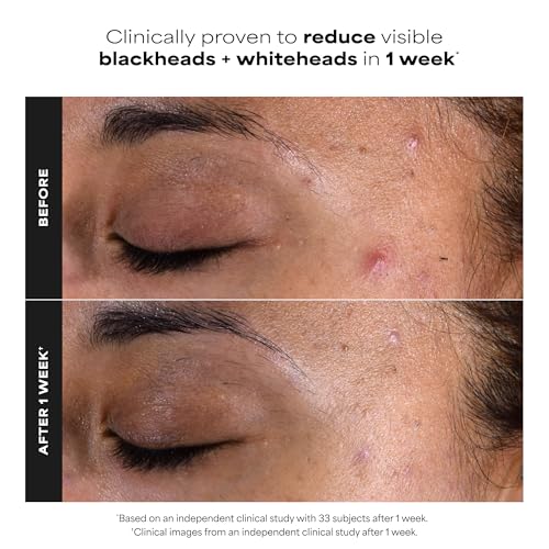 Paula's Choice 2% BHA Exfoliating Pads - Salicylic Acid for Pores
