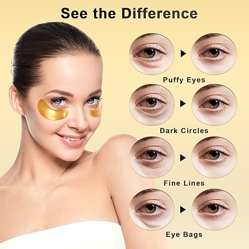 Under Eye Patches (36 Pairs) - Valentines Day Gifts for Women, 24K Gold Eye Masks Enriched with Abundant Collagen for Dark Circles, Puffy Eyes, Wrinkles - Vegan & USA Tested