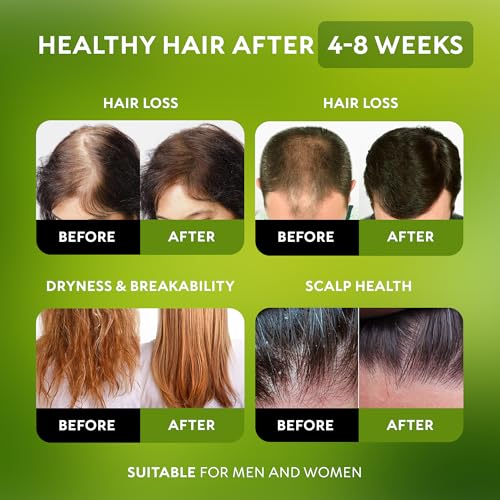 Batana Oil for Hair Growth - 100% Raw & Organic 4.23 oz