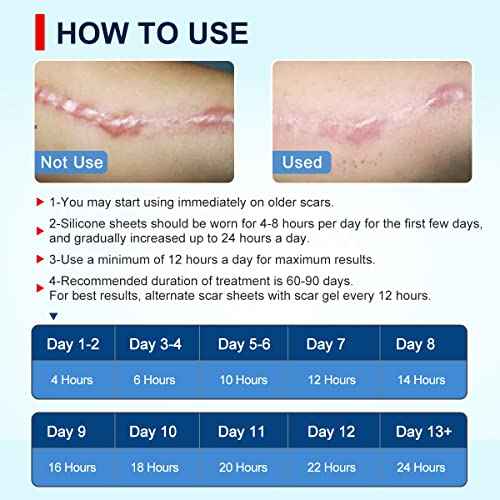 Silicone Scar Sheets Tape for Surgical Scars, C Section Scar Silicone Strips, Medical Grade, Reusable, Soften and Flattens Scars, Breast, Keloid, Professional Scar Patches. (1.8x157 Inch)