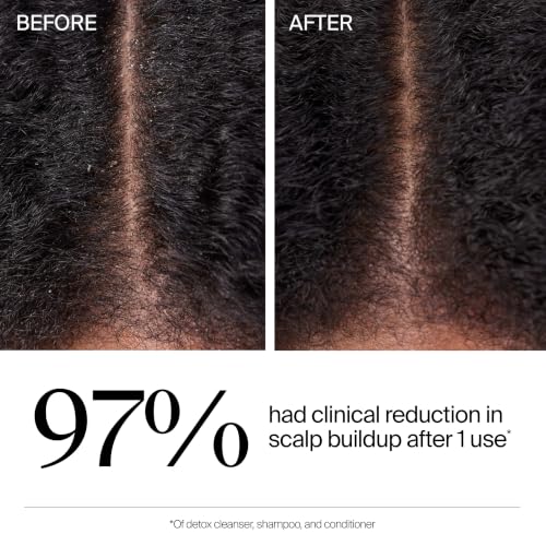 Neutrogena Hair Restore Scalp Detox Cleanser, 8 fl oz