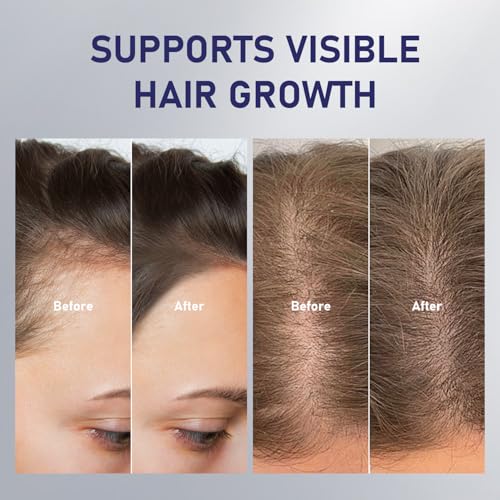 GHK-Cu Copper Peptide Hair Growth Spray for Men & Women