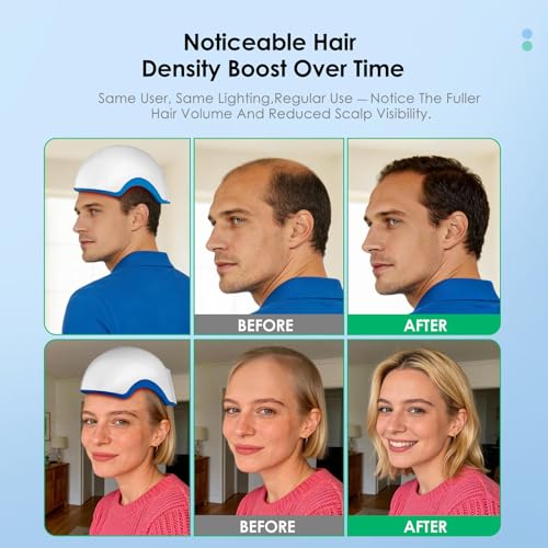 FDA-Cleared Red Light Therapy Hair Loss Helmet with 162 Laser Diodes
