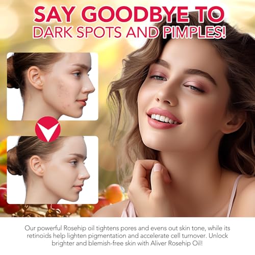 2 Pack Rosehip Oil for Face,100% Pure Organic Rosehip Seed Oil Cold Pressed Moisturizer for Hair, Skin & Nails 4 fl.oz