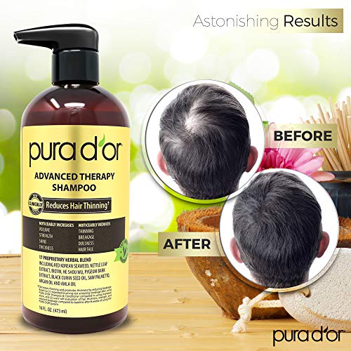 PURA D'OR Advanced Therapy Shampoo (16oz) Reduces Hair Thinning & Increases Volume, No Sulfate, Biotin Shampoo Infused with Argan Oil, Aloe Vera for All Hair Types, Men & Women (Packaging May Vary)